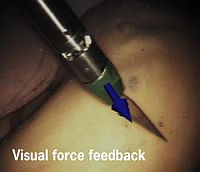 DLR telesurgical scenario: visual force display